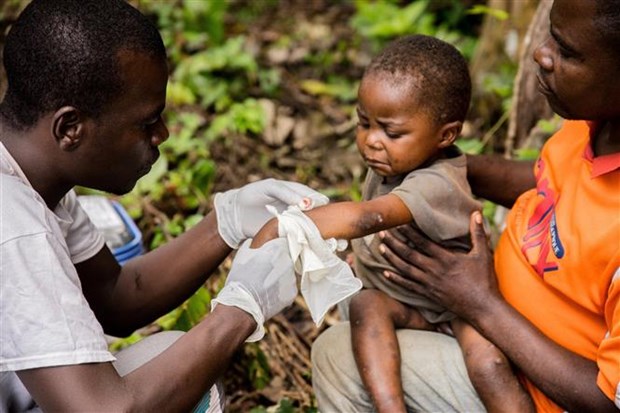 WHO: Chưa cần tiêm đại trà vaccine ngừa bệnh đậu mùa khỉ